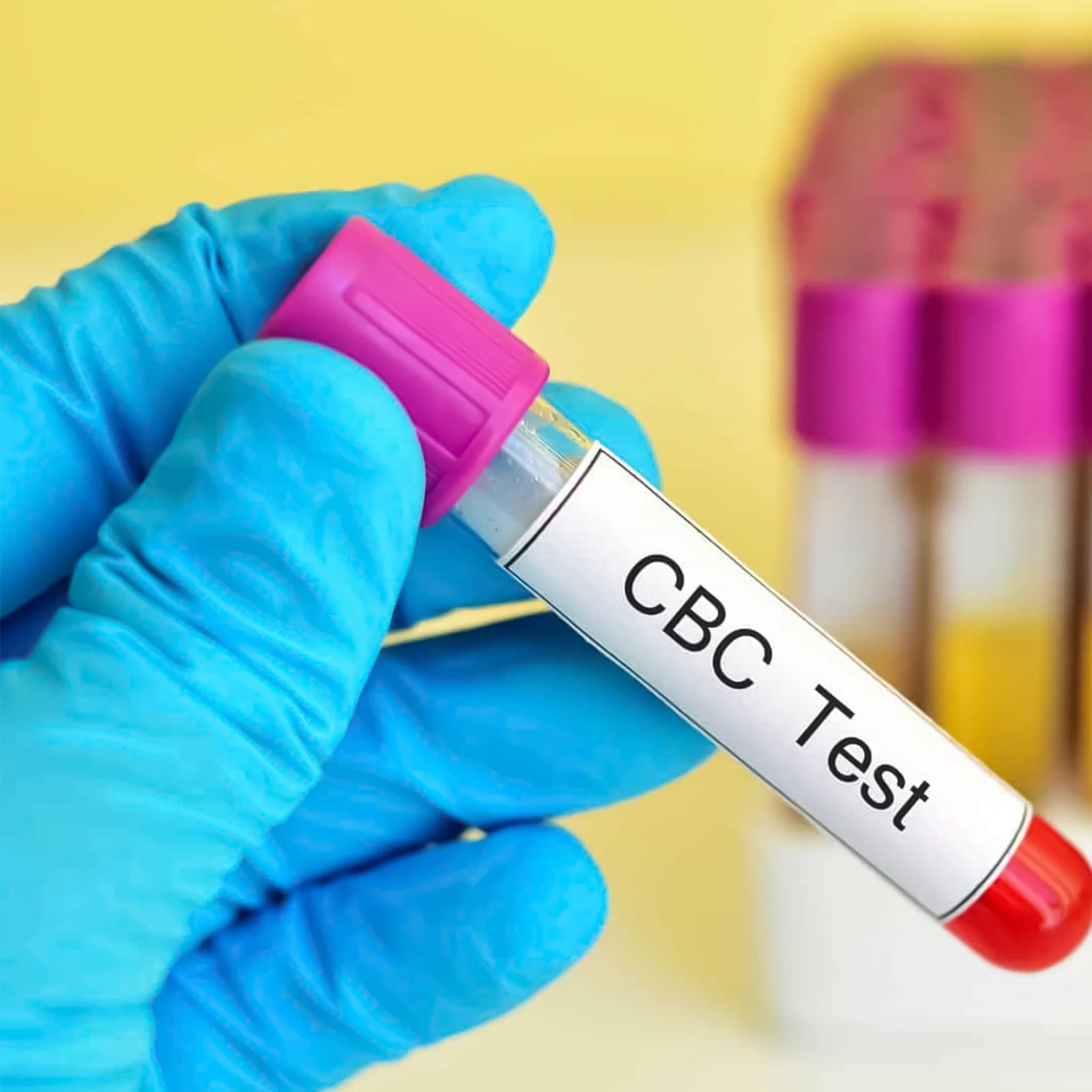 Complete Blood Count Test