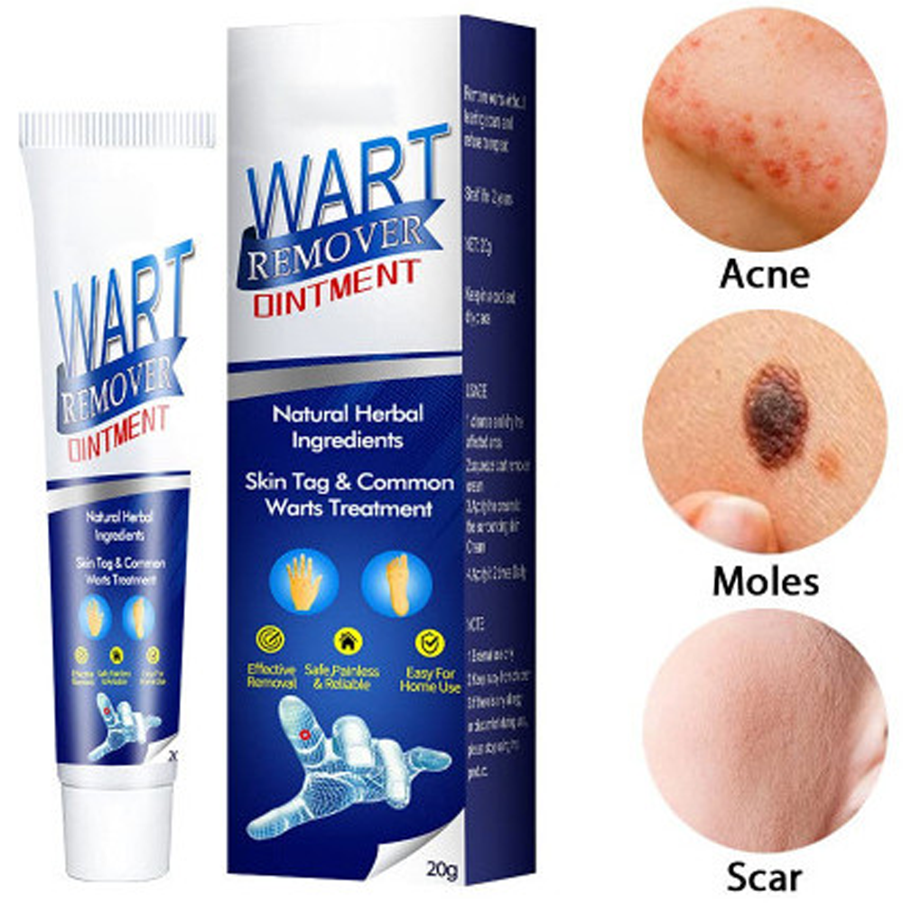 Wart Remover Ointment - 20gm